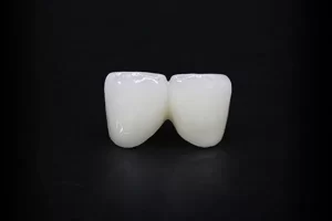 ceramic-crown-lithium-disilicate