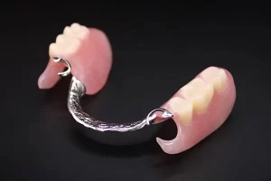 dental-laboratory-products-philippines-metal-denture