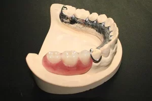 dental-laboratory-products-philippines-pfm-05